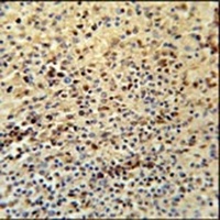 Anti-SPATA13 Antibody