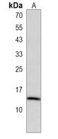 PCP2 Rabbit Polyclonal Antibody