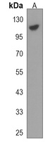 ADAMTS15 Rabbit Polyclonal Antibody