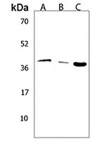 Hepsin Rabbit Polyclonal Antibody