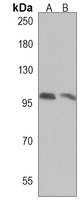 ADAMTS6 Rabbit Polyclonal Antibody
