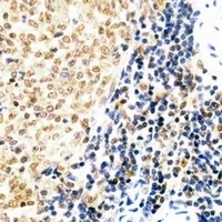 Anti-SUZ12 Antibody