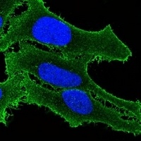 Anti-ATP2B3 Antibody