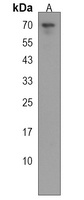 NURR1 Rabbit Polyclonal Antibody