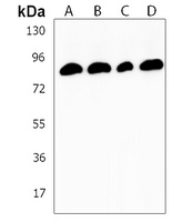 RSK1 Rabbit Polyclonal Antibody