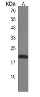 FAM168B Antibody