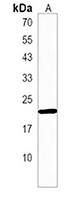 PSF1 Rabbit Polyclonal Antibody