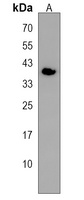 OR4K17 Rabbit Polyclonal Antibody