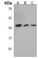 LMCD1 Rabbit Polyclonal Antibody