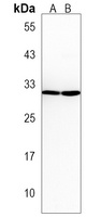 Oligo3 Rabbit Polyclonal Antibody