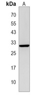 TREX2 Rabbit Polyclonal Antibody