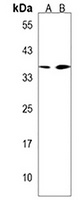 UTF1 Rabbit Polyclonal Antibody