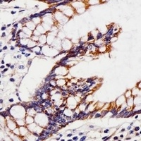 Anti-CHST12 Antibody