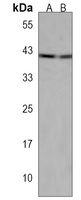 RING1 Rabbit Polyclonal Antibody