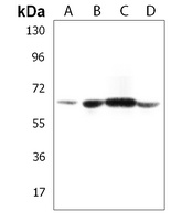 ACSM5 Rabbit Polyclonal Antibody