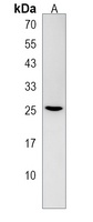 Oligo3 Rabbit Polyclonal Antibody