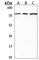 SDAD1 Rabbit Polyclonal Antibody