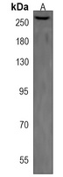 ROS Rabbit Polyclonal Antibody