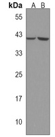 SBK1 Rabbit Polyclonal Antibody