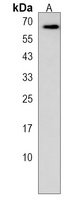 ZIM2 Rabbit Polyclonal Antibody