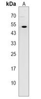 TRIM43B Rabbit Polyclonal Antibody