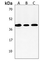 ACADSB Rabbit Polyclonal Antibody