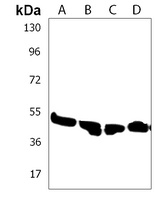 ZDHHC11 Rabbit Polyclonal Antibody