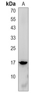 SPANXA1 Rabbit Polyclonal Antibody
