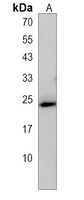 TMEM239 Antibody