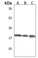 CYS1 Rabbit Polyclonal Antibody