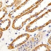 Anti-CYS1 Antibody