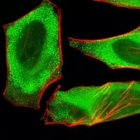 Anti-XAF1 Antibody