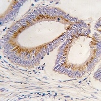 Anti-GDF11 Antibody