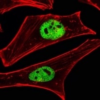 SMARCD3 Rabbit Polyclonal Antibody