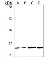 NDUFB4 Antibody