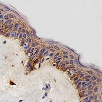 NDUFB4 Antibody