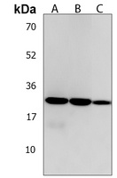 FAM216B Rabbit Polyclonal Antibody