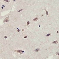 FAM216B Rabbit Polyclonal Antibody