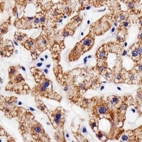 Anti-AGAP8 Antibody