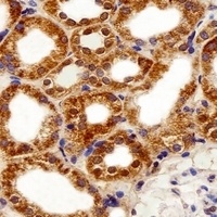 Anti-FBXL17 Antibody