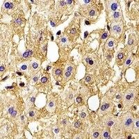 Anti-HBG2 Antibody