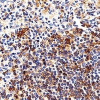 Anti-HLA-DRB1 Antibody