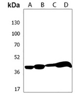 HLA-B Rabbit Polyclonal Antibody