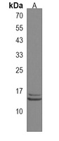 IQCF6 Antibody