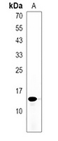 POLR2J3 Rabbit Polyclonal Antibody