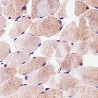 Anti-SLC25A25 Antibody