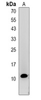 RPS21 Rabbit Polyclonal Antibody