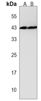 SIRPB1 Rabbit Polyclonal Antibody