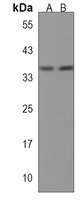 RPLP0P6 Rabbit Polyclonal Antibody
