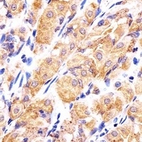 RPLP0P6 Rabbit Polyclonal Antibody